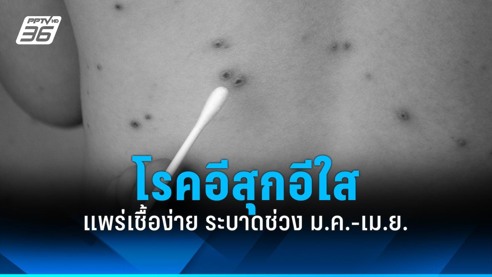 ภาพประกอบ