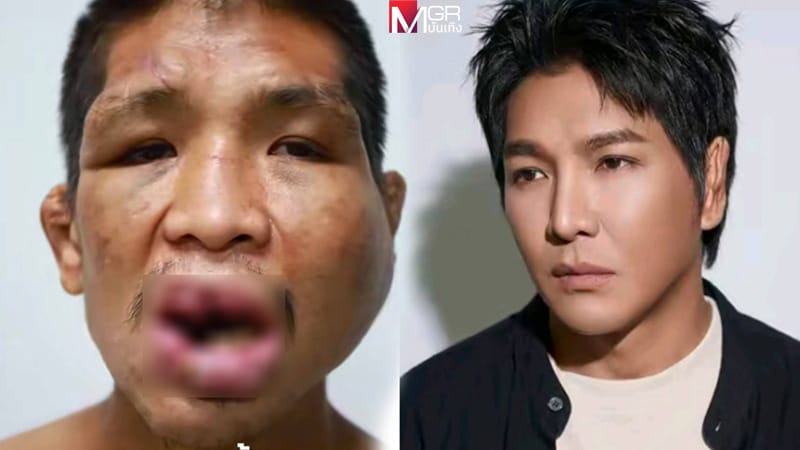 ภาพประกอบ