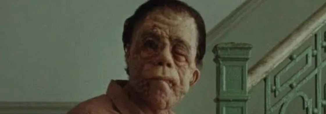 Adam Pearson: จากพรมแดง Oscars สู่บทบาท The Elephant Man ที่สร้างประวัติศาสตร์