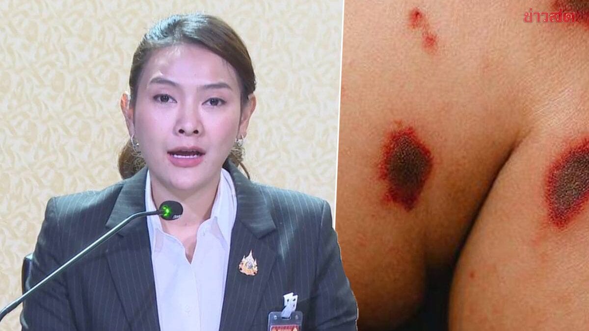 ไข้กาฬหลังแอ่น: รู้เท่าทัน ปกป้องตนเองและคนที่คุณรักจากโรคร้าย