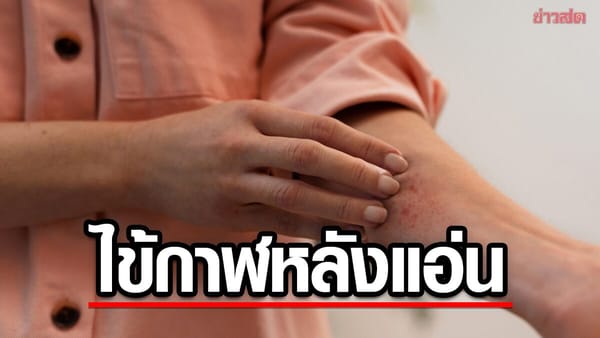 โรคไข้กาฬหลังแอ่น: รู้ทันภัยใกล้ตัว ป้องกันและรับมือได้อย่างไร?